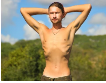 Imagen relacionada con obesidad